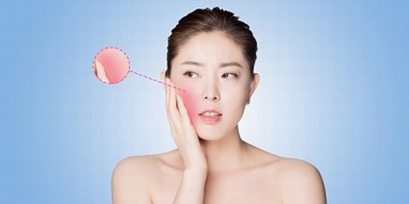 敏家：擺激素臉反復糾纏 你必須要有清晰的認知